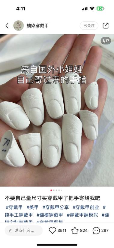 图片[2]-赛道：定制版穿戴甲
溢价比较高，利….-网创风向标论坛-网络创业-网创圈